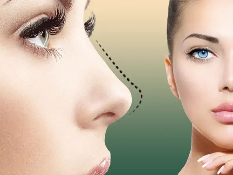 از بازسازی بینی