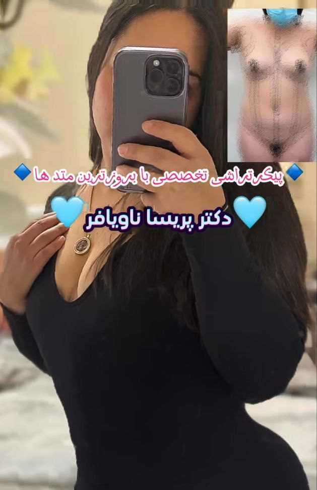 عکس نمونه عمل لیپوماتیک دکتر پریسا ناویافر