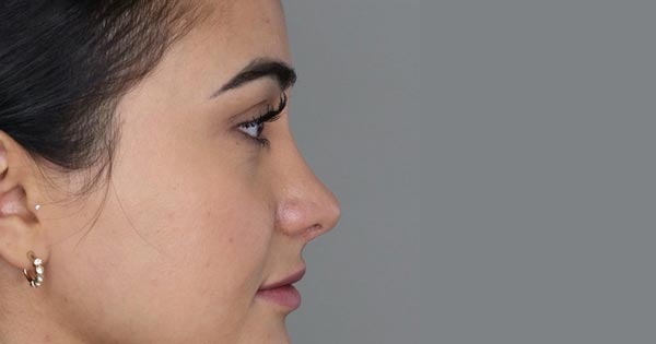 عمل بینی 