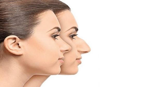 عمل بینی قوزدار در مشهد